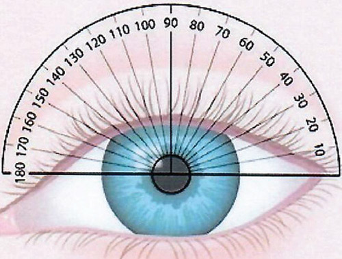 Axis orientation over eye | Astigmatism
